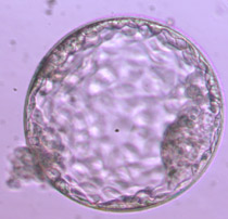 Hatching blastocyst 5AA